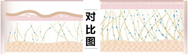 blob.png